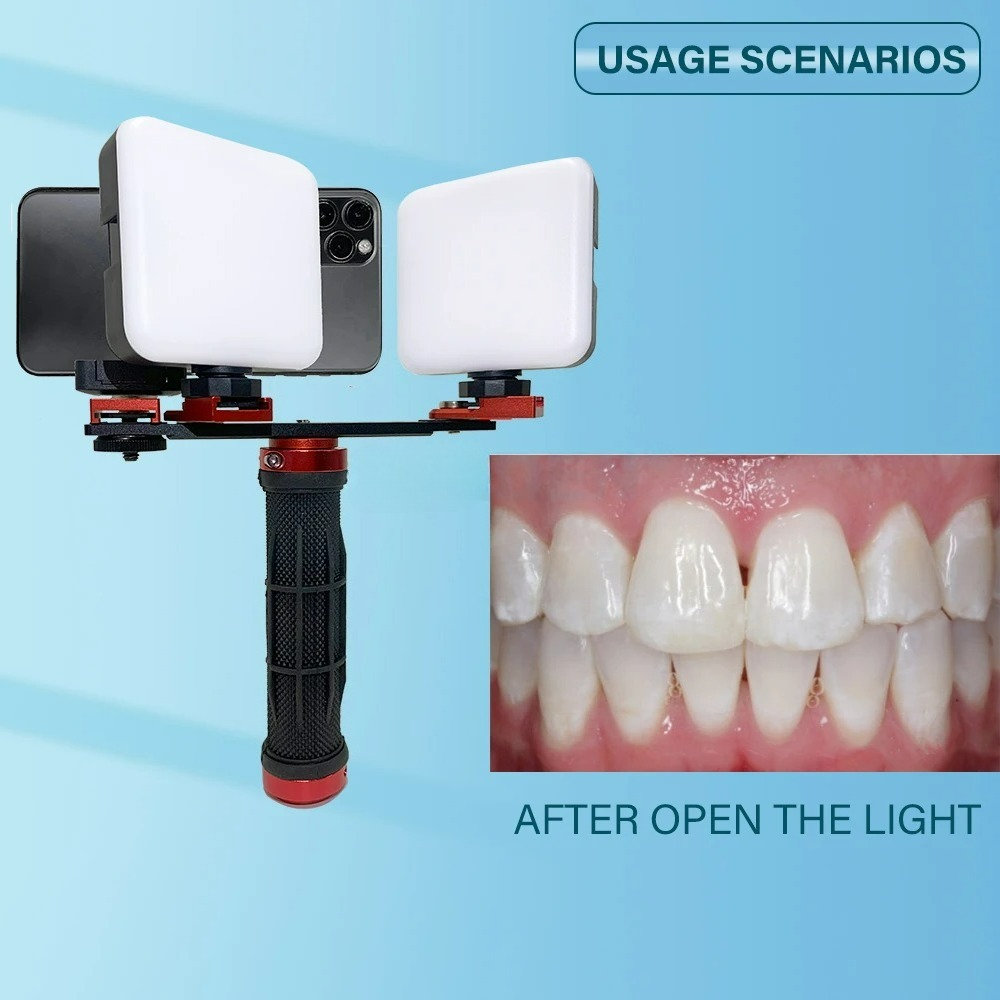 Lampu Fotografi Gigi untuk Pon - Photography Lighting Accessories ulasan dan harga